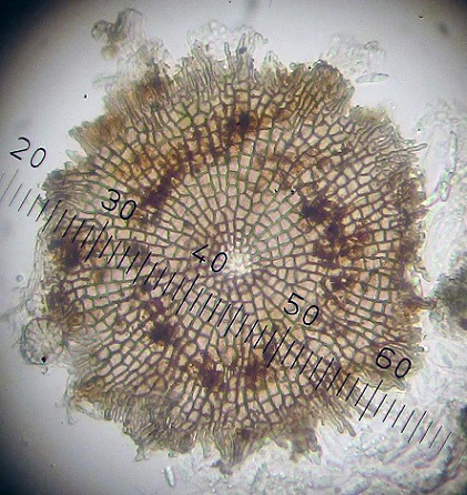 Microthyrium ciliatum (door Laurens van der Linde)